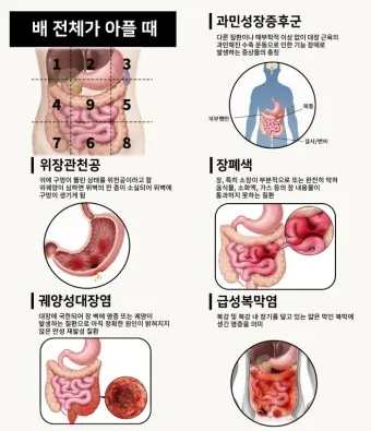 왼쪽 아랫배 통증 움질일때 콕콕 땡김_40