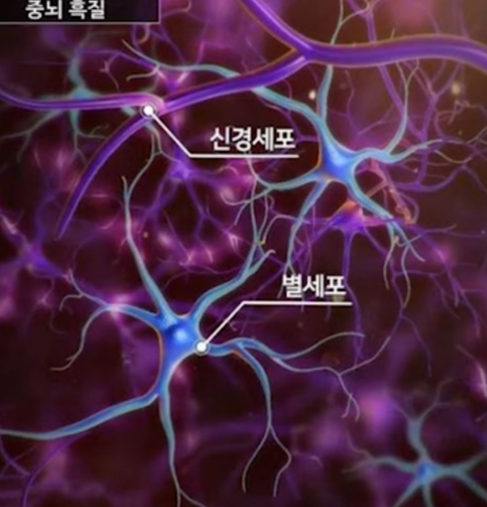 파병:어싱접지호일판을 머리밑에 깔고 누어보겠습니다