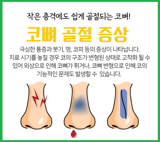 코뼈골절증상