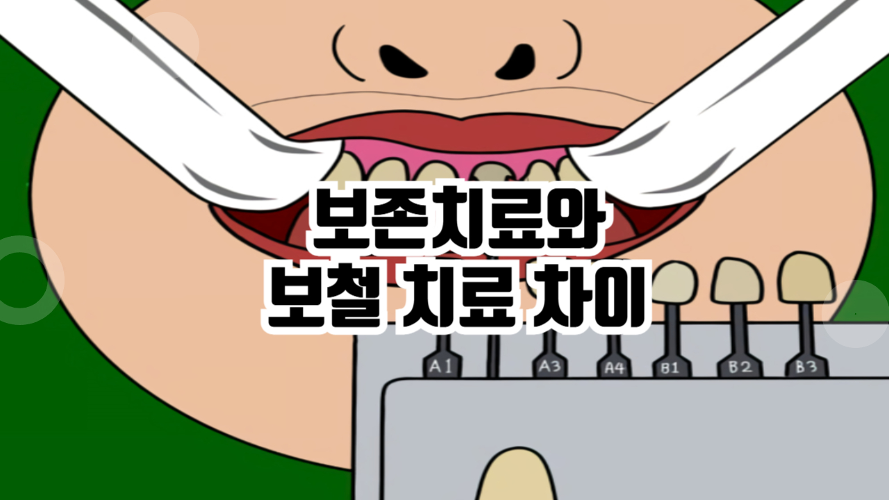 치아 보존치료