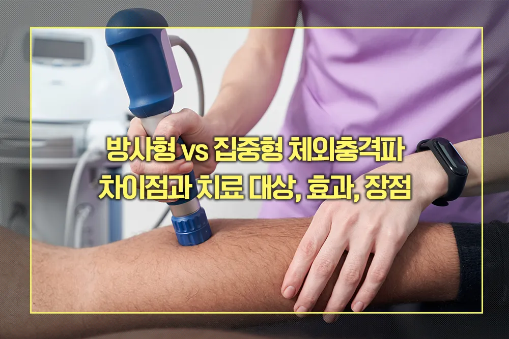 방사형 집중형 체외충격파 차이점 효과