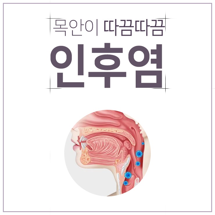 역류성 후두염. 흔한 증상이라고 해서 방심하지 마세요. 4