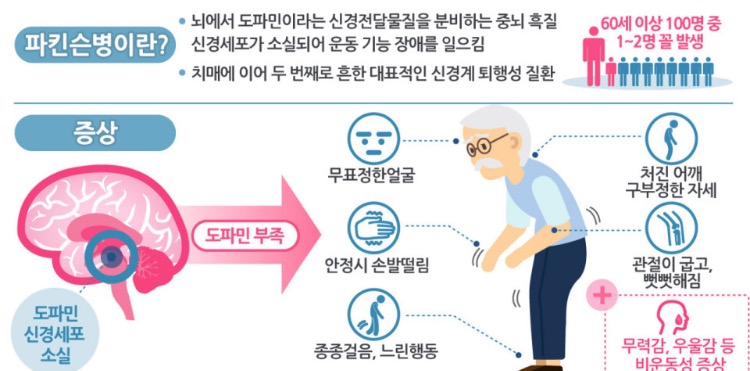 수전증이란? 수전증의 원인 및 3