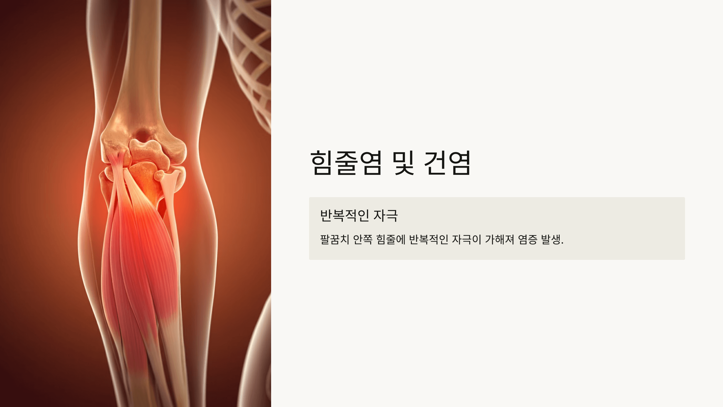 팔꿈치 사진입니다.