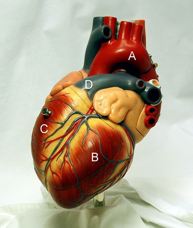 Percutaneous coronary intervention 경피적관상동맥중재술