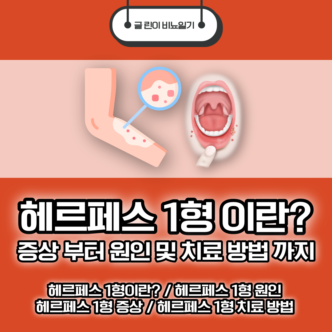  헤르페스 1형 이란? 증상 부터 원인 및 치료 방법 까지