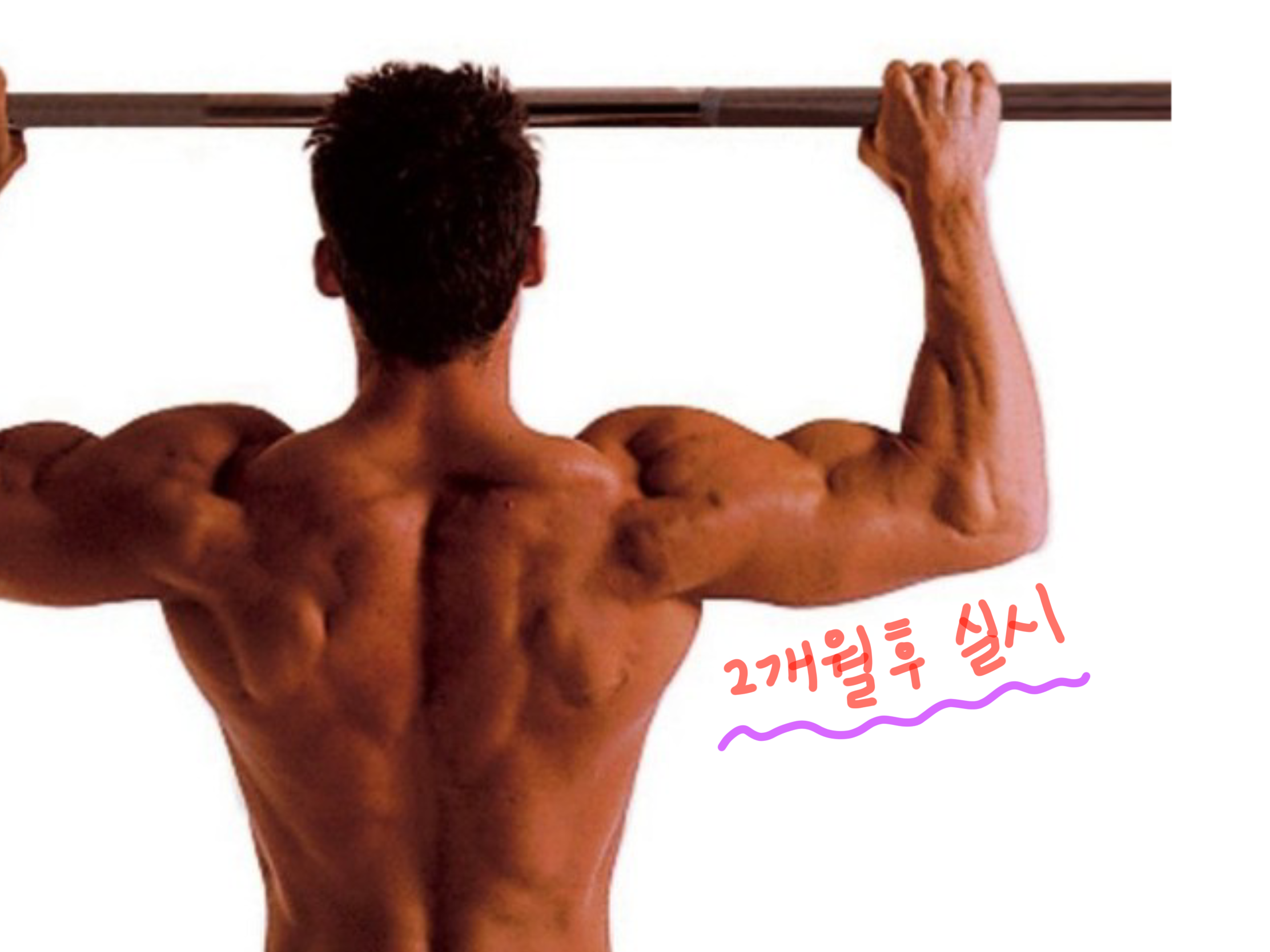  백내장 수술후 주의사항 알아보자