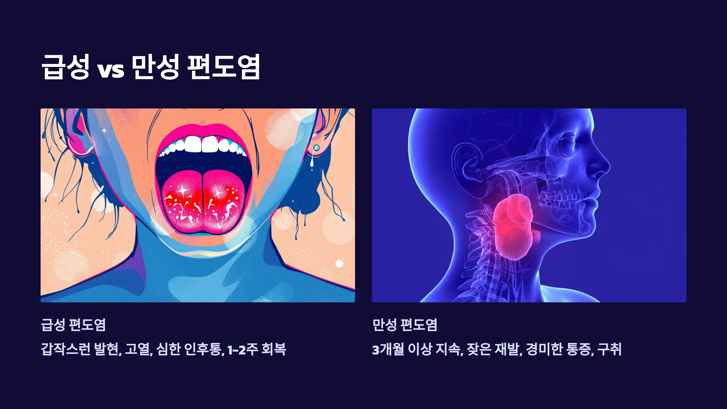 급성/만성편도염에 대한 소개 PPT 이미지