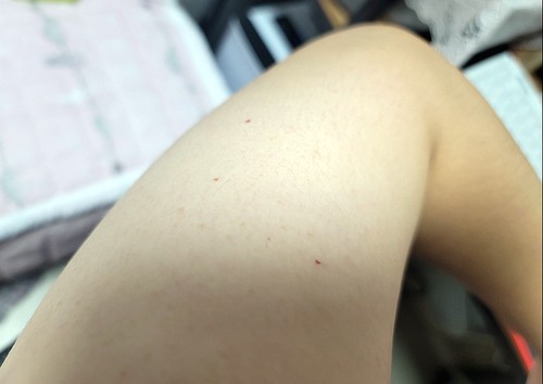  침대 진드기 제거 저만의 노하우 공유할게요!