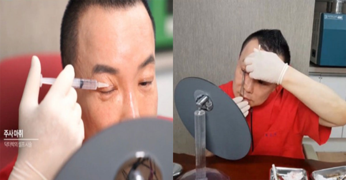  세계 최초 마취부터 수술까지 혼자 쌍커풀 수술하는 의사