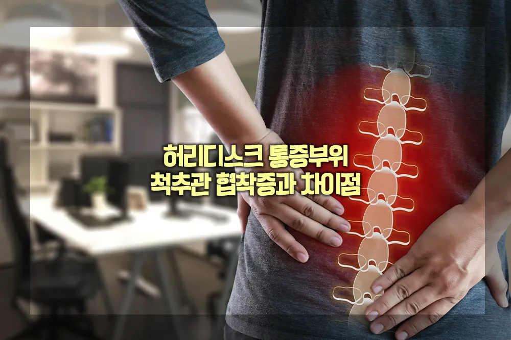 허리디스크 통증부위 척추관 협착증