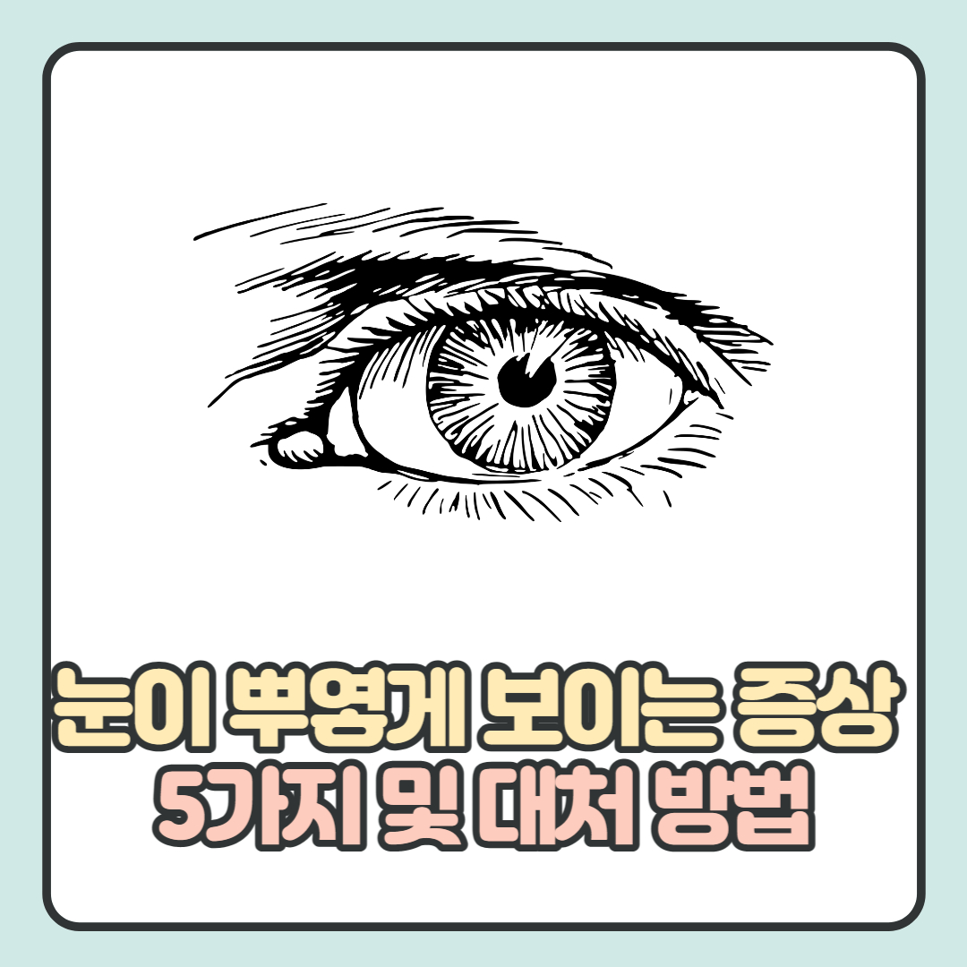  눈이 뿌옇게 보이는 증상 5가지 이유 및 대처 방법 알아보기