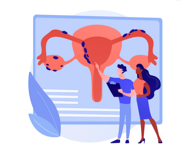 자궁내막증 증상과 원인, 자궁내막증 수술 자궁내막증 증상과 원인, 자궁내막증 수술
