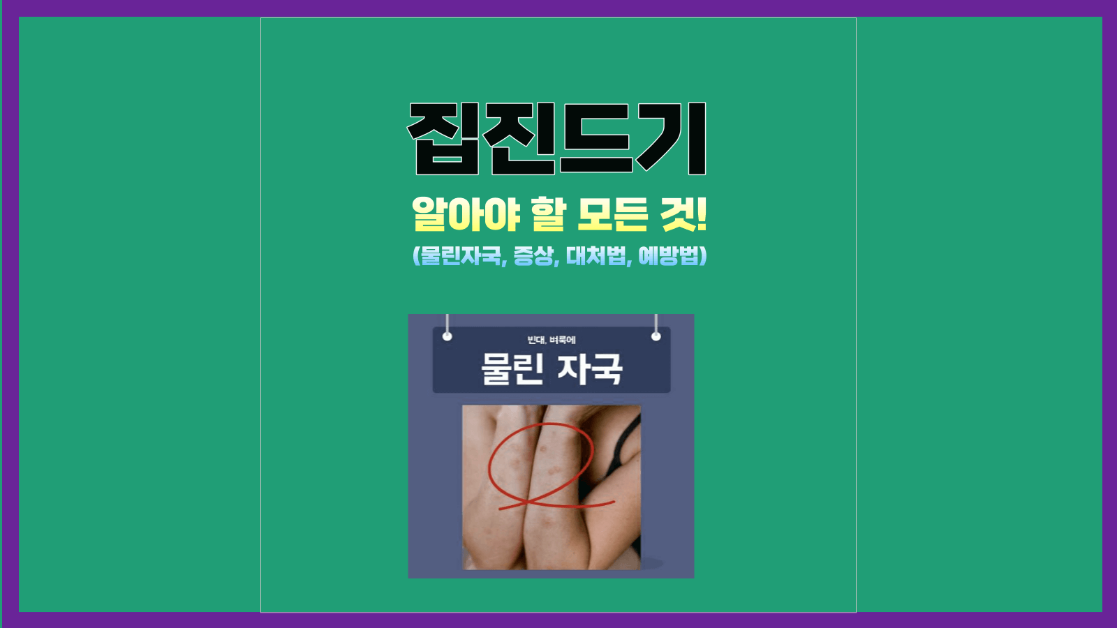 집진드기: 알아야 할 모든 것!