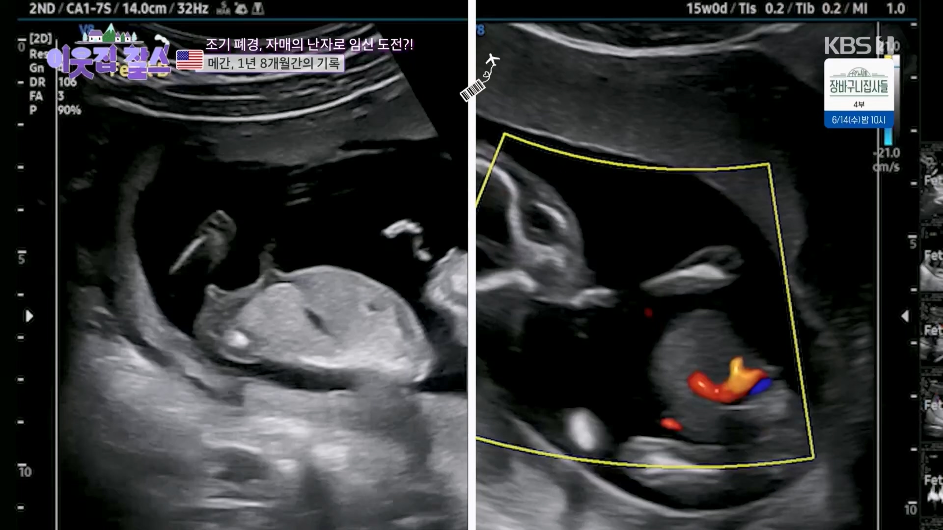 이웃집 찰스.E389.230530p.H264-F1RST.mp4_20230601_205002.699.jpg