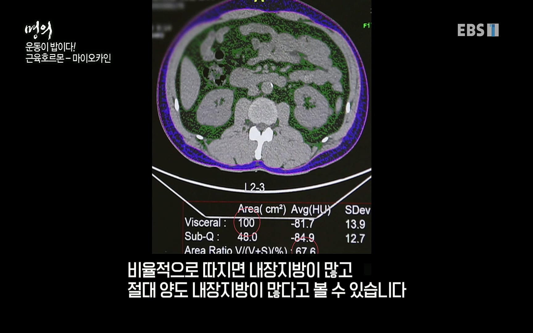 EBS 명의 헬스케어 - TV - 교육의 중심 EBS내 몸을 지배하는 7가지 호르몬 3부, 운동이 밥이다! .mp4_20220711_202506.414.jpg
