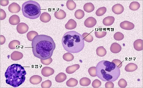 백혈구 수치가 낮은 이유