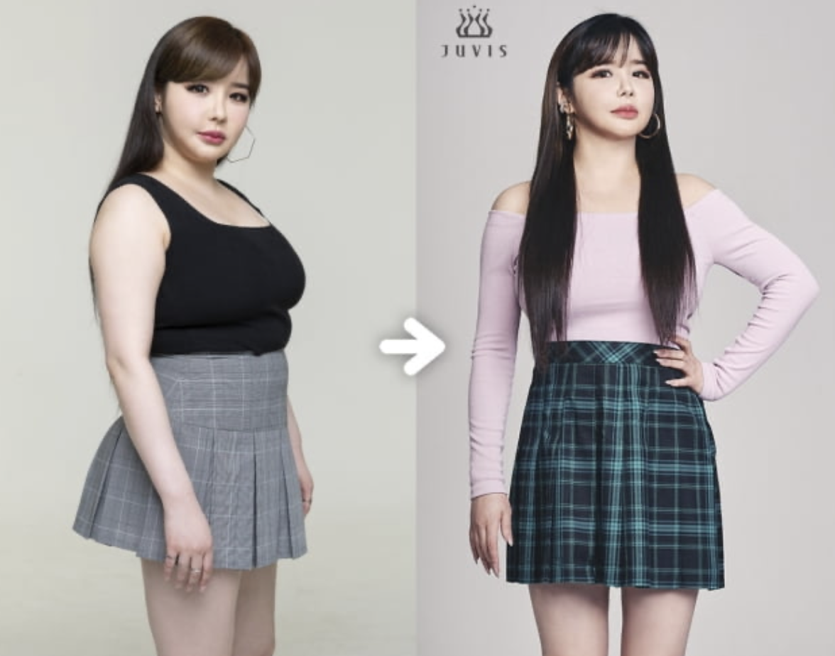 박봄