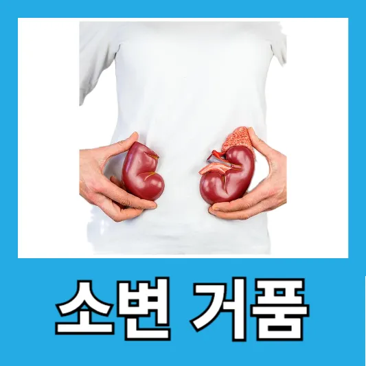 소변 거품 부종 피로감 소변량 변화 단백뇨 원인 증상 진단 치료