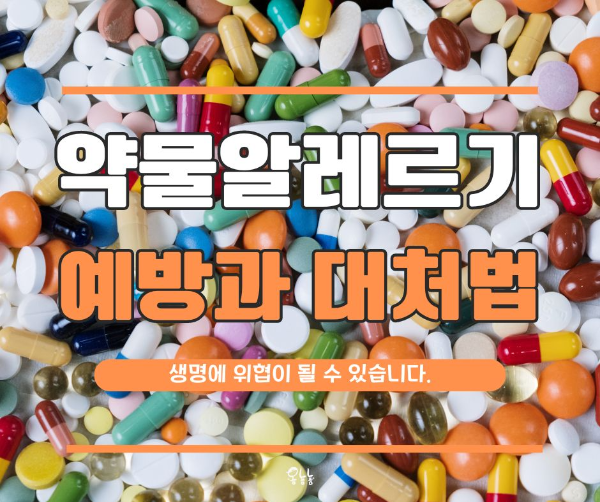 약물 알레르기