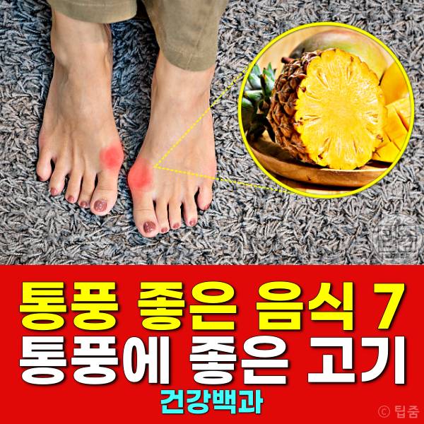 통풍에 좋은 음식 통풍에 좋은 고기