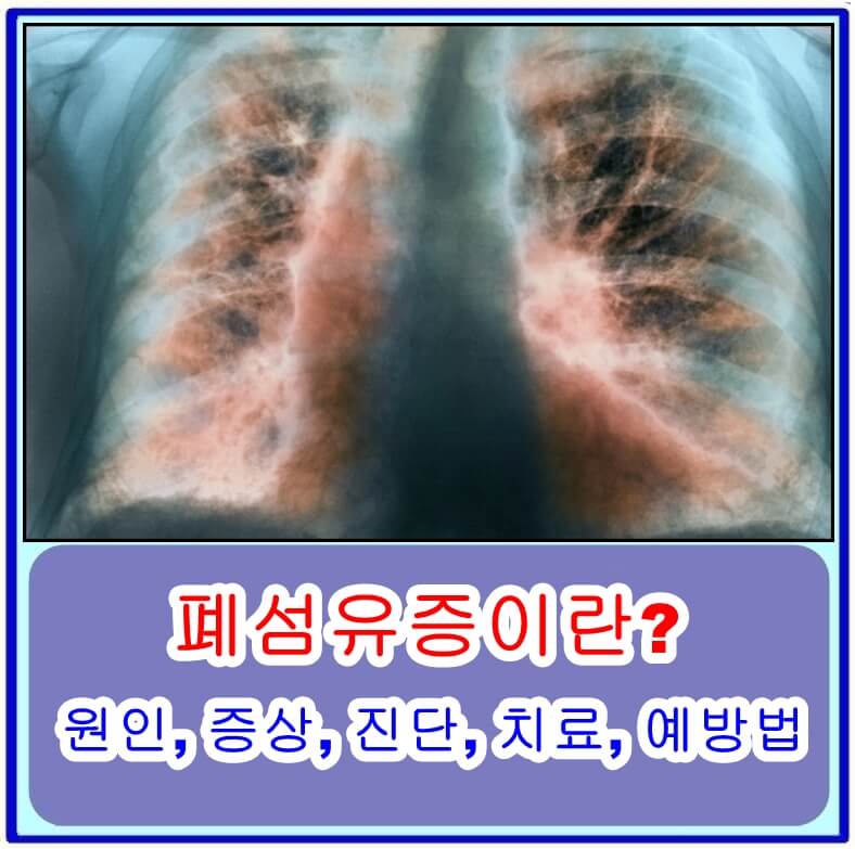폐섬유증