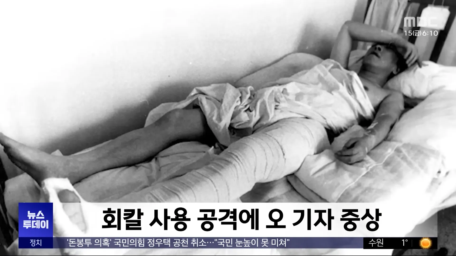 회칼 사용 공격에 오 기자 중상