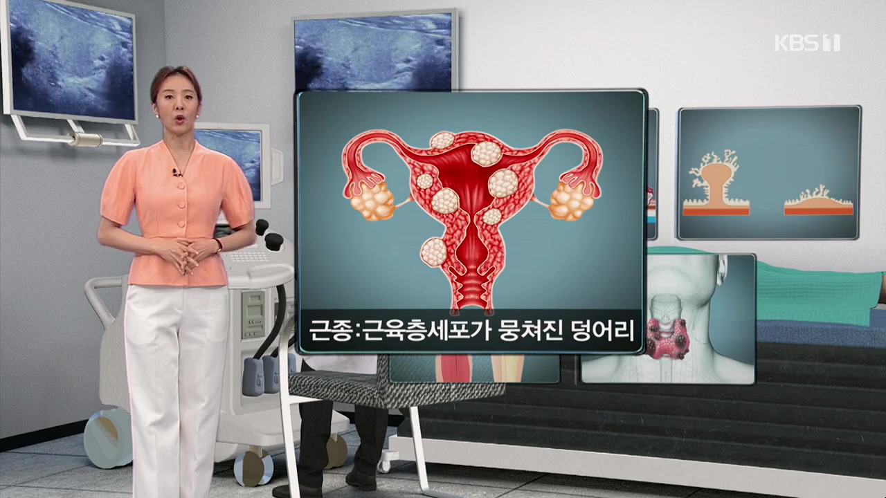 생로병사의 비밀.E870.230532p.H264-F1RST.mp4_20230605_195516.356.jpg