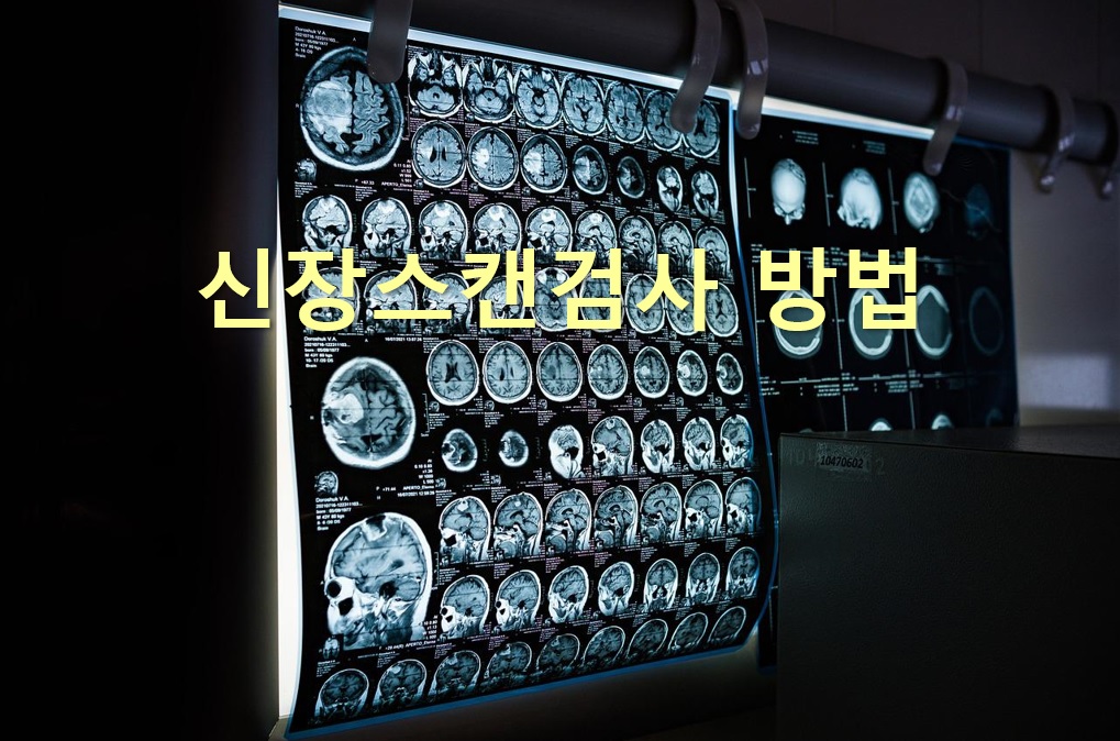  신장 혈류와 소변 배설 기능을 진단하는 신장스캔검사 방법