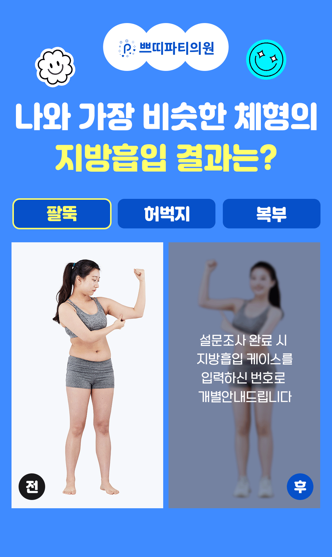 허벅지 지방흡입으로 날씬해진 다리라인 후기! 7