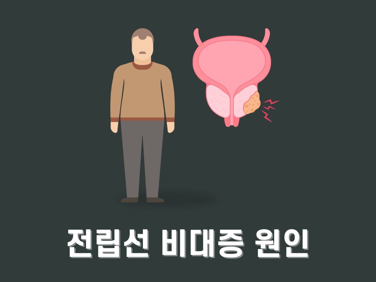 전립선 비대증 원인
