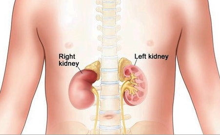 바테르증후군 증상 R(Renal&#44; 신장) 이상