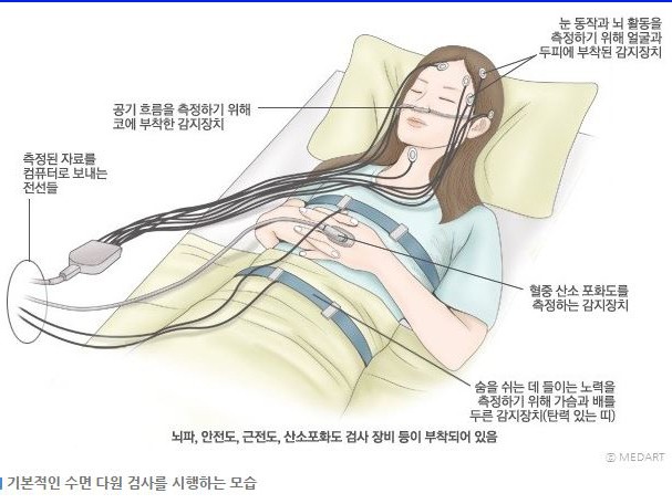 수면다원검사모습