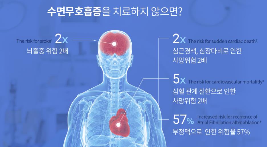 이명과 수면 무호흡증.