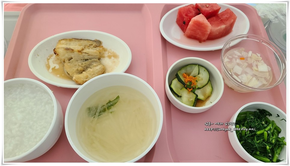 담낭 쓸개 제거 아주대학교병원 7