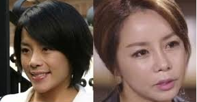  탤런트 신이 성형전후 사진과 양악 수술 이유