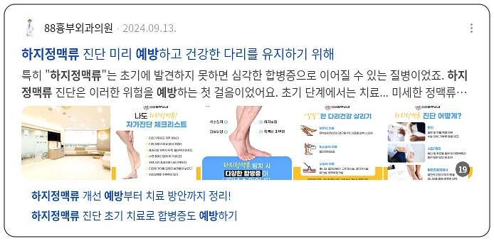 하지정맥류 예방_2_subsection