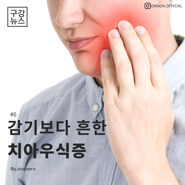 [구강정보] #6 감기보다 흔한 치아우식증, 충치에 대하여