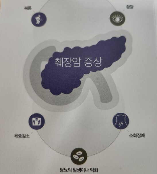  췌장암의 원인 증상 예방법 진단법 치료법