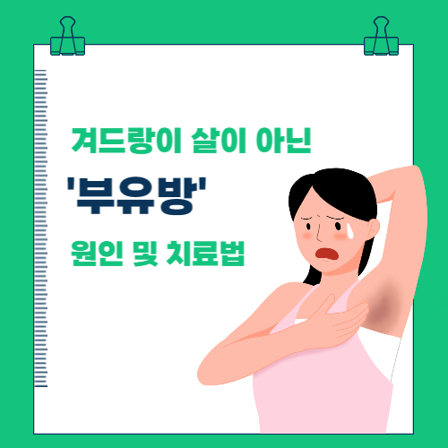  겨드랑이 살이 아닌 '부유방' 원인 및 치료법