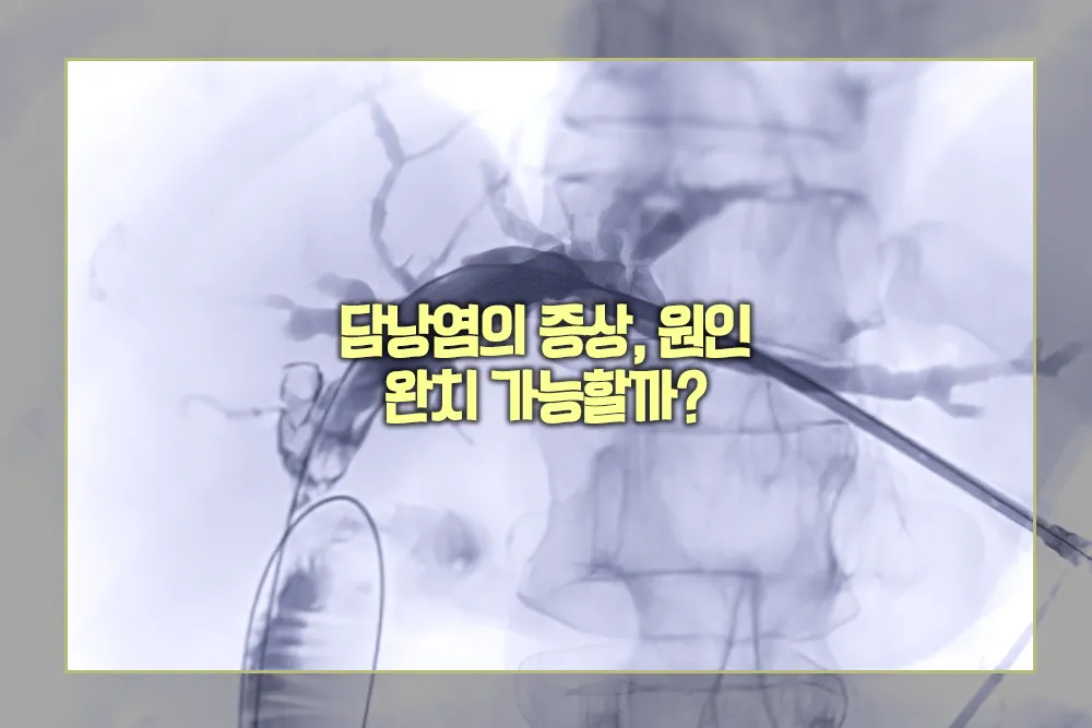 담낭염 증상 원인 완치