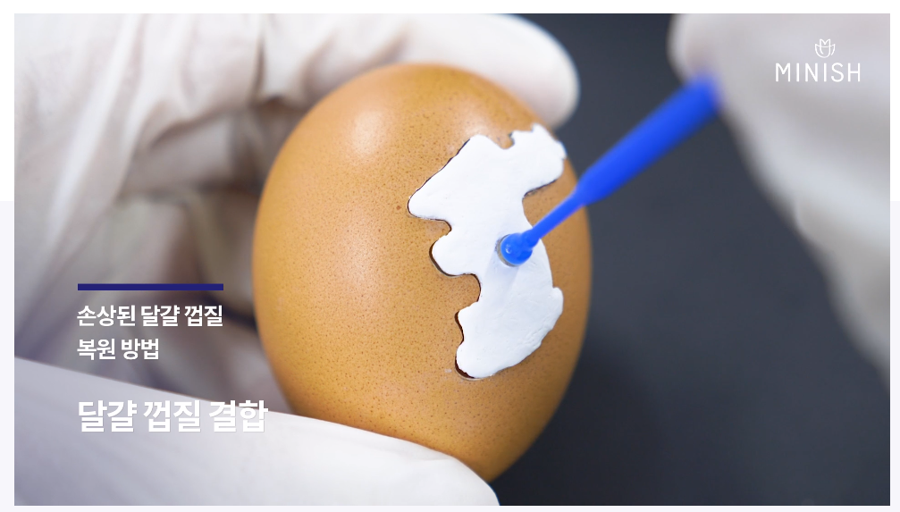 미니쉬 치과병원, 미니쉬 가격 아세요 (완벽정리)