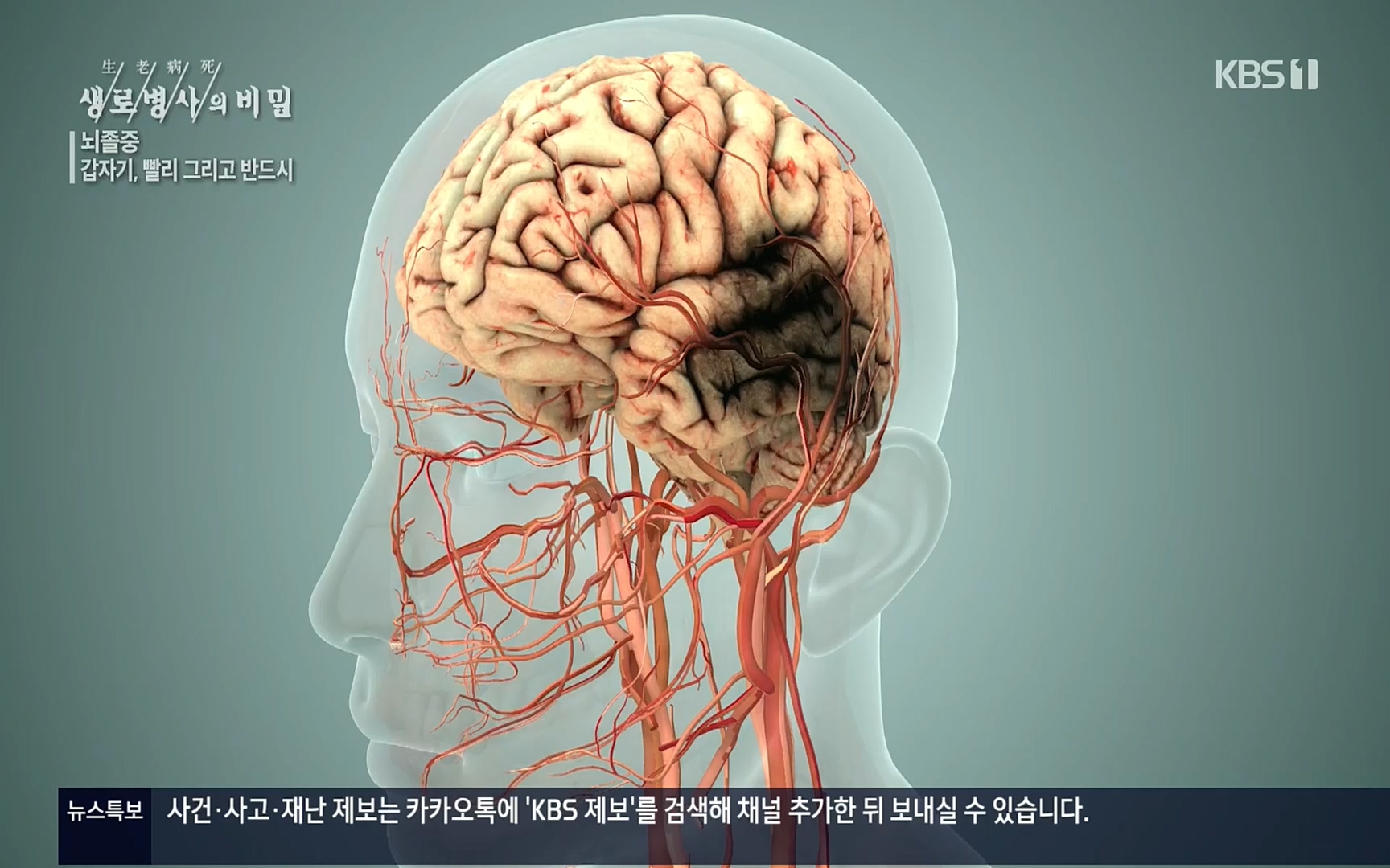 생로병사의 비밀.E835p.H264-F1RST.mp4_20220917_181732.357.jpg