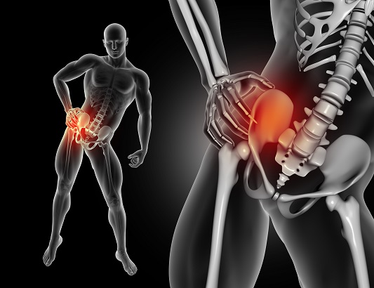 hipbone-neuralgia
