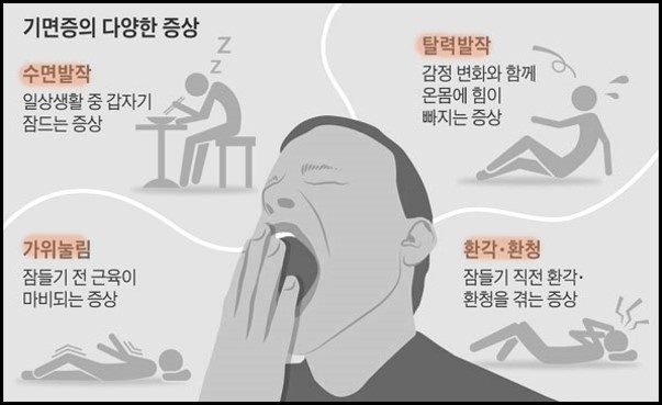 대구의 과수면증과 기면증의 차이는? (특발성 과수면에 대하여) 8