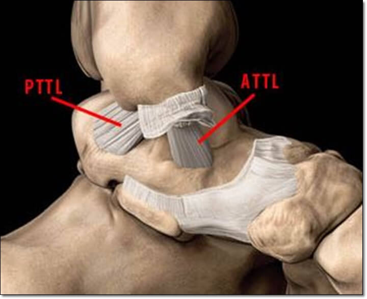 심부 인대의 부착 부위를 나타내는 사진