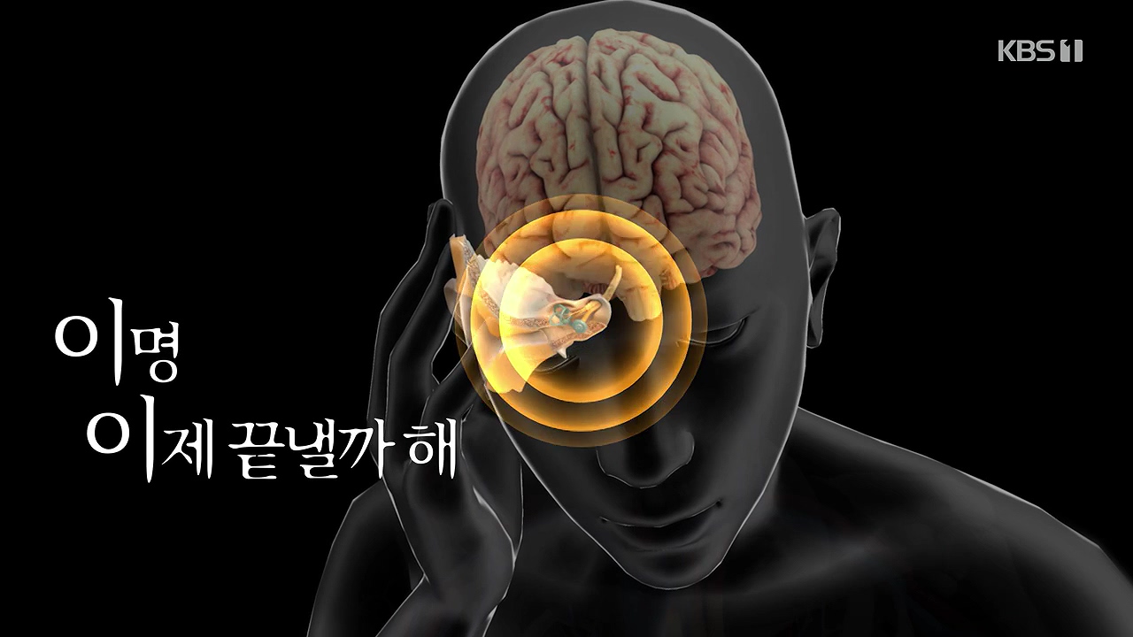 생로병사의 비밀.E883.230914p-NEXT.mp4_20230914_202400.661.jpg