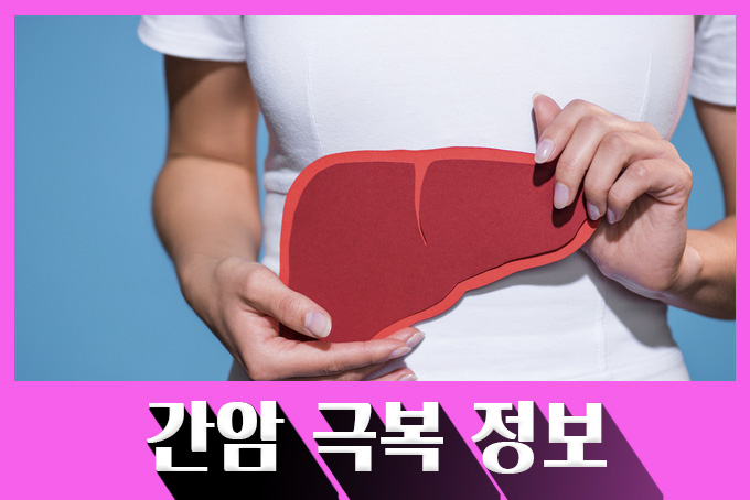  [암 정보] 간암이란? 간암 예방법과 간암 치료방법은?