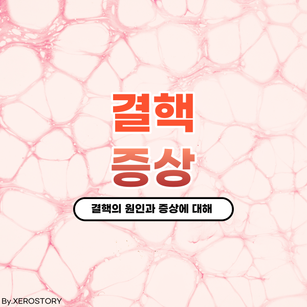 결핵이란 뭘까? 결핵의 원인과 증상에 대하여
