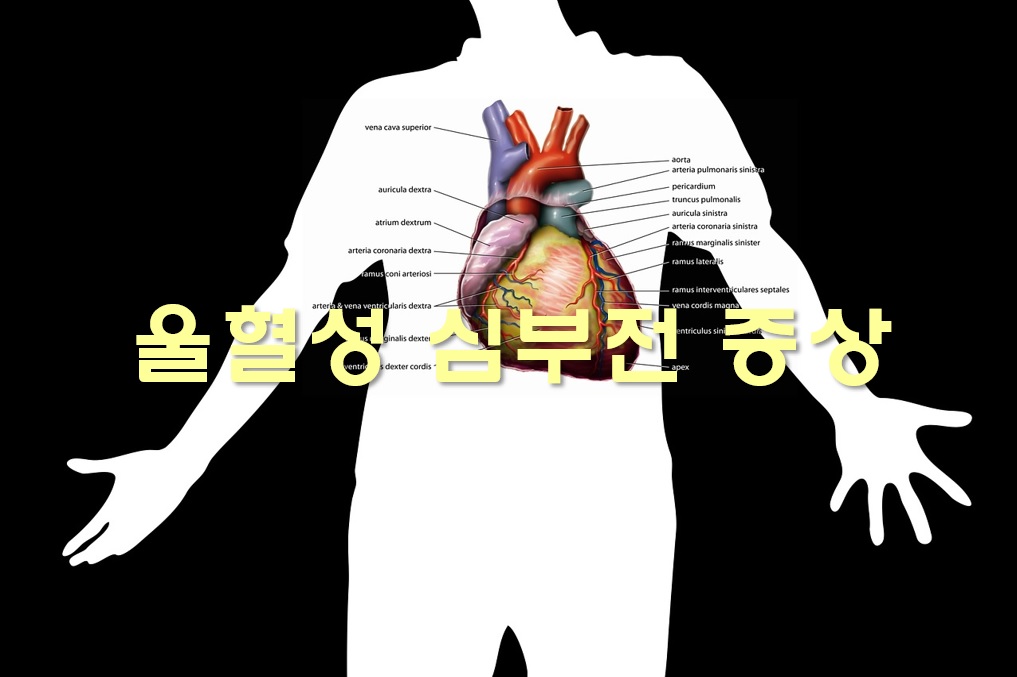  울혈성 심부전 증상과 치료 방법